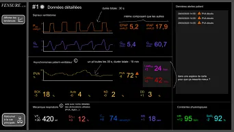 Maquette de la deuxième interface
